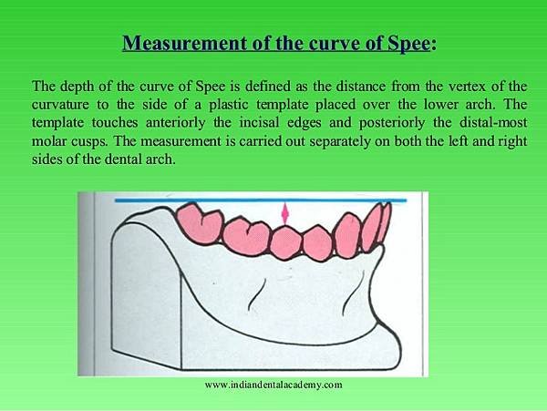 @齒顎矯正每日一說~~0154 curve of Spee(