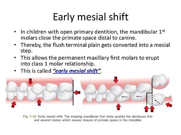 development-of-occlusionkritika-30-728.jpg