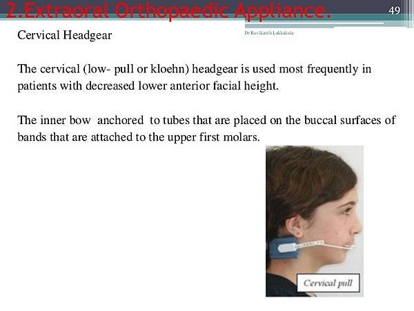 management-of-low-angle-case-in-orthodontics-49-638.jpg