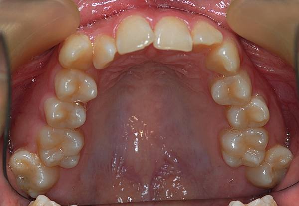 @齒顎矯正每日一說~~0203齒顎矯正的診斷過程是很需要智慧