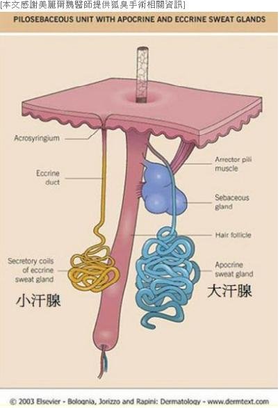 狐臭5