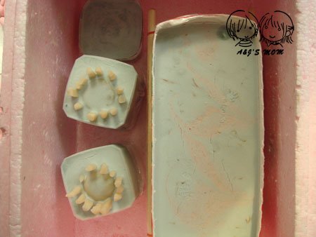 鬆膏1.jpg