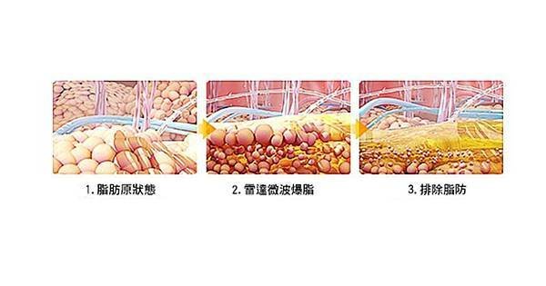 瘦身-3.jpg