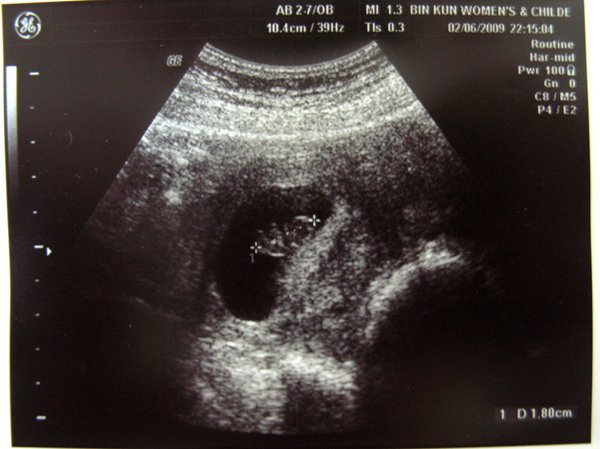 fig.1