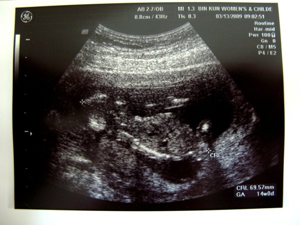 fig.3