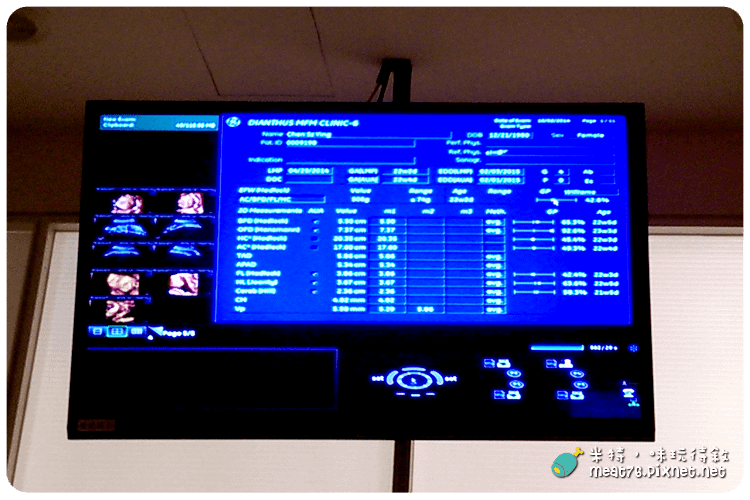 米特，味玩待敘｜部落格 © MEAT76｜台灣美食旅遊部落客｜2014-10-02-4【懷孕產檢紀錄7番外篇】24W+4D｜禾馨婦產科｜高層次超音波檢查 ( 自費3,800元 ) 建議20~24週檢查008.png