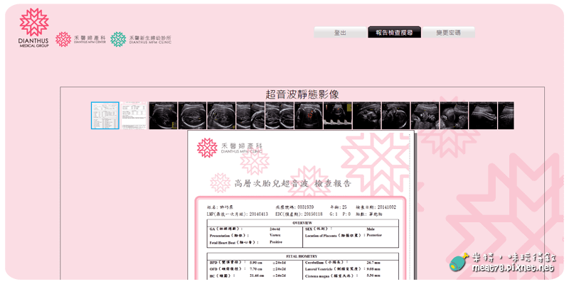 米特，味玩待敘｜部落格 © MEAT76｜台灣美食旅遊部落客｜2014-10-02-4【懷孕產檢紀錄7番外篇】24W+4D｜禾馨婦產科｜高層次超音波檢查 ( 自費3,800元 ) 建議20~24週檢查010.png