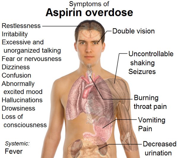 Symptoms_of_aspirin_overdose.jpg