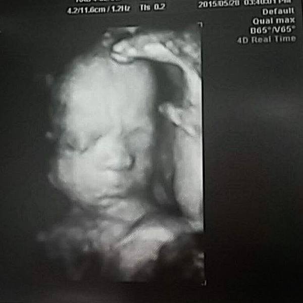 28w-5