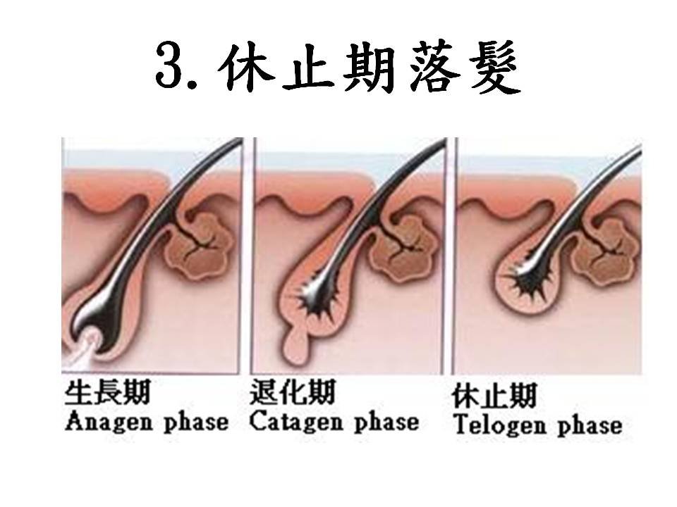 投影片17