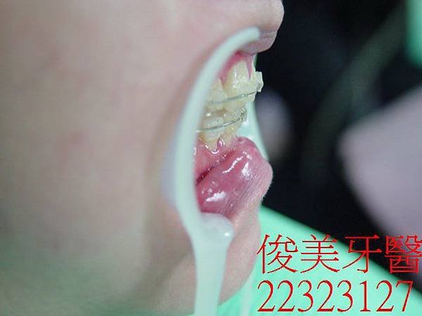 0718 (16)