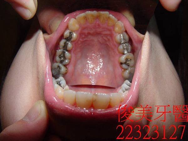 菊080531( 0)