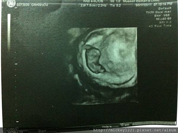 9wks-1.JPG