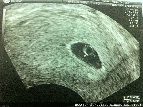 6wks-3