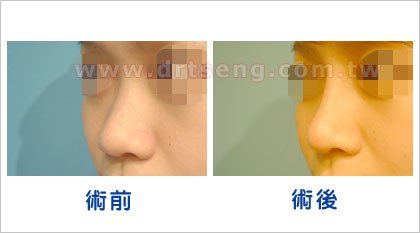 pic-5