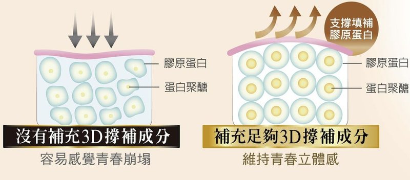 3D撐補成分示意圖