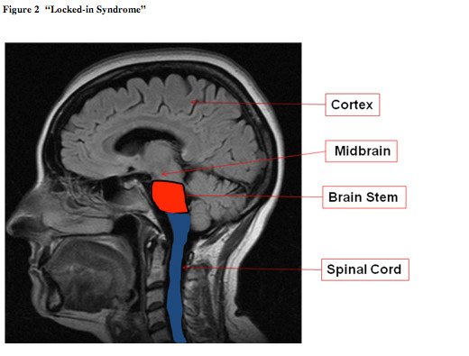 MRI