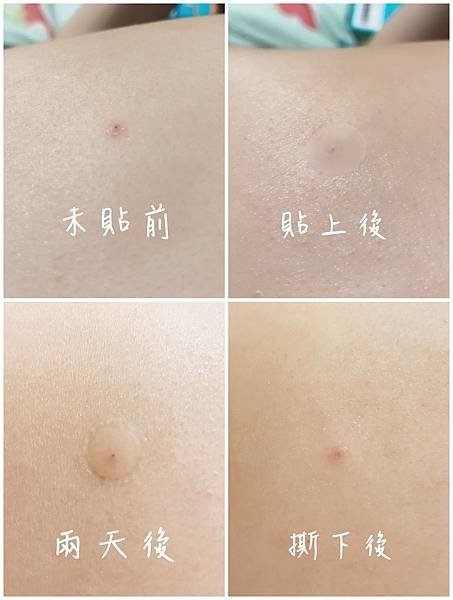S__5136420-tile.jpg
