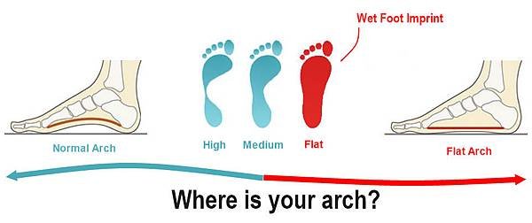 Flat-Foot-Arch-Z-CoiL1.jpg