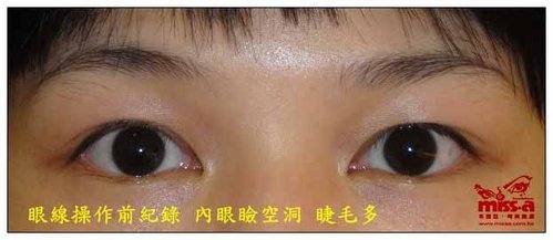 眼線操作前