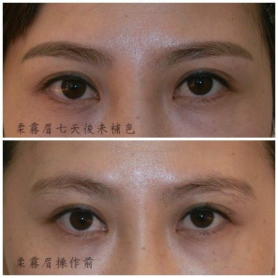 柔霧眉前後.jpg