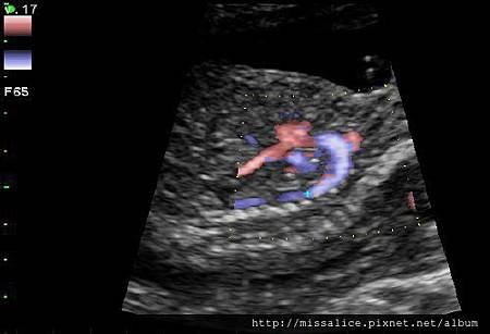 baby2.JPG