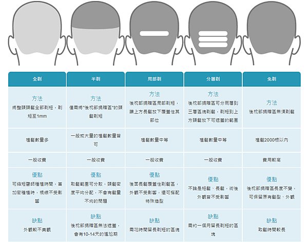 ▲不同植髮手術剃髮方式，可以選擇在植髮期間維持外觀形象。