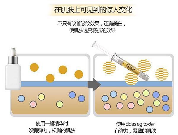 擷取4