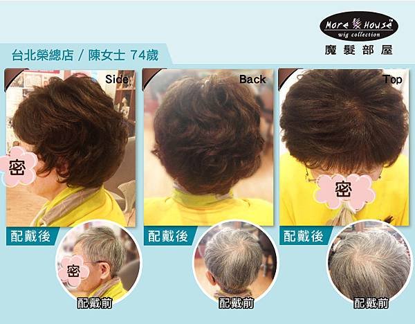 樂活銀髮_榮總店陳女士74歲_02