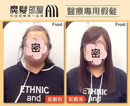 醫療假髮1.jpg