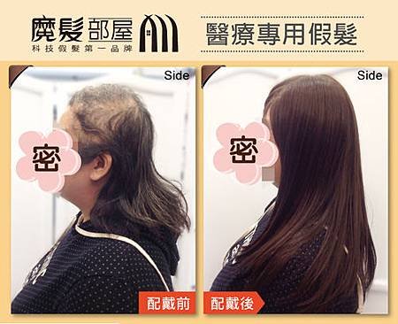 醫療假髮2.jpg