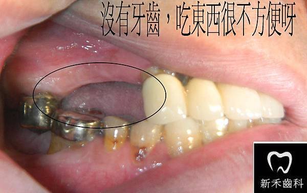 部落格3