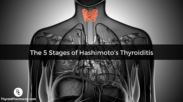 The5StagesofHashimotosThyroiditis.png