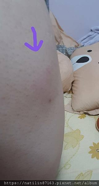 130575好痛嗚嗚嗚.jpg