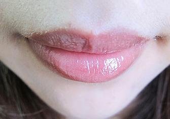 LIP2