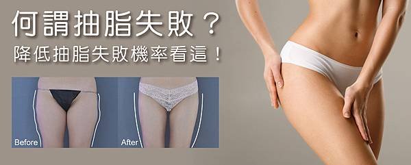 抽脂失敗01.jpg