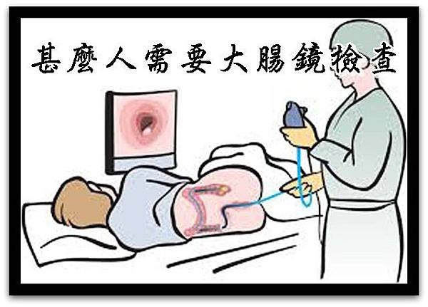 甚麼人需要大腸鏡檢查