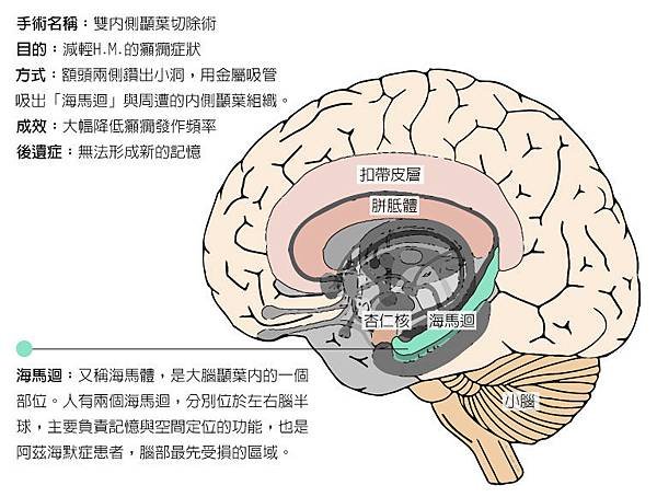 brain1