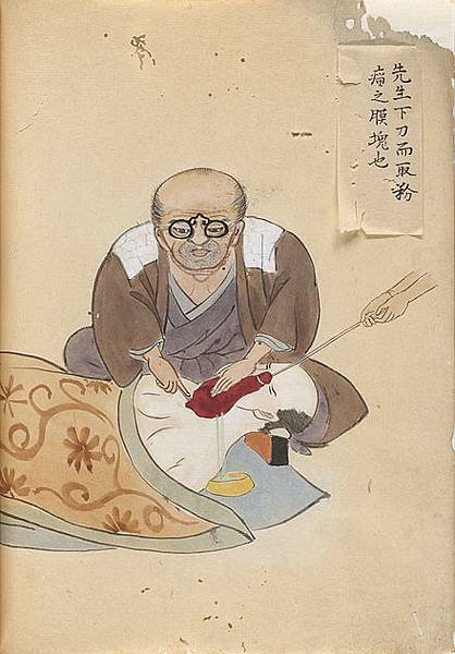 440px-Image_from_-Surgical_Casebook-_by_Hanaoka_Seishu