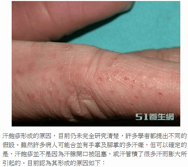 帶狀皰疹疫苗+汗皰疹/唇皰疹/蕁麻疹/有一種皮膚病，很教人討