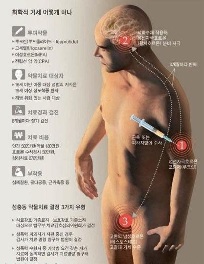 化學閹割-化學去勢/利用針孔攝影偷拍、攝影機偷窺和其他的性犯