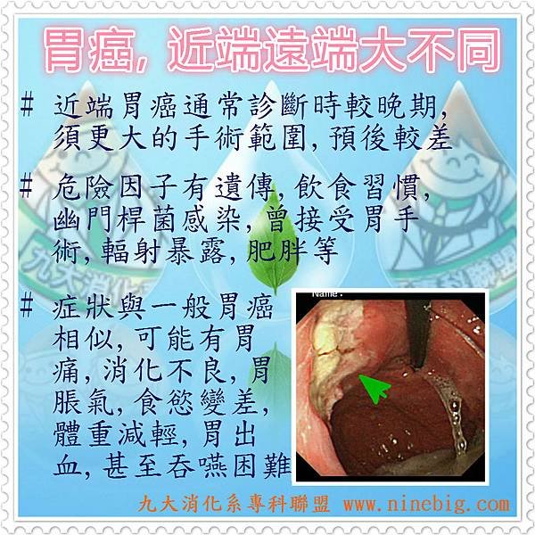 FB近端胃癌(水滴).jpg