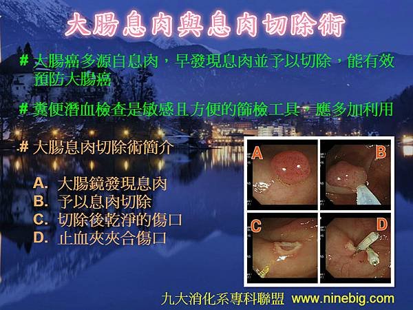 大腸息肉切除術(105).jpg