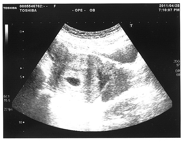 20110428-1.gif