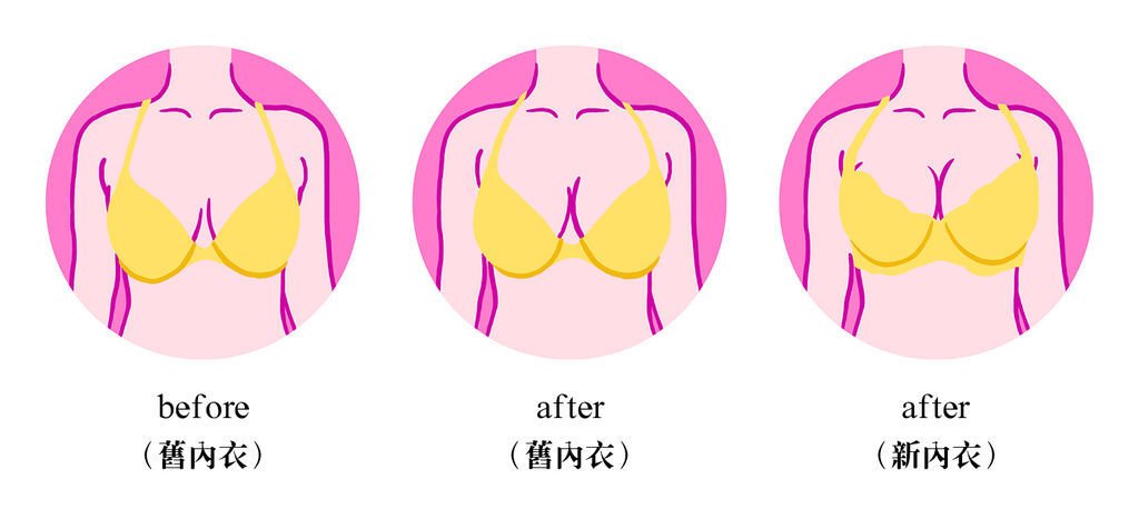 (比較)胸型變化.jpg