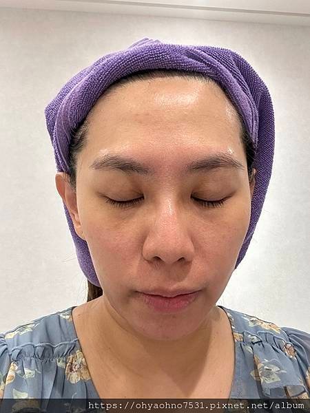 [台北音波拉提診所分享] 愛爾麗診所 非侵入式療程的HIPR