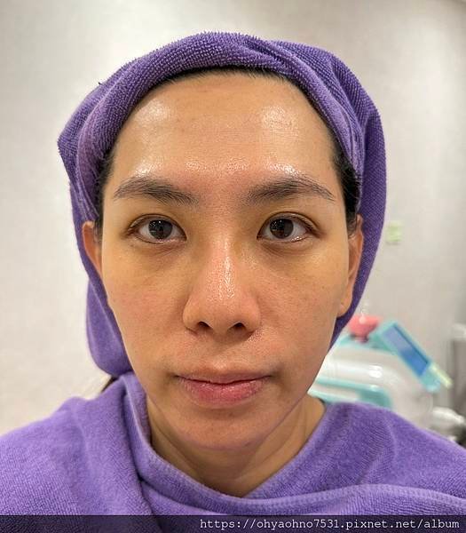 [台北音波拉提診所分享] 愛爾麗診所 非侵入式療程的HIPR