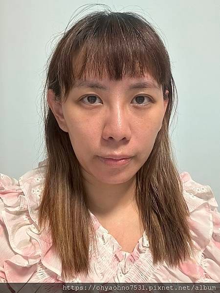 [台北音波拉提診所分享] 愛爾麗診所 非侵入式療程的HIPR
