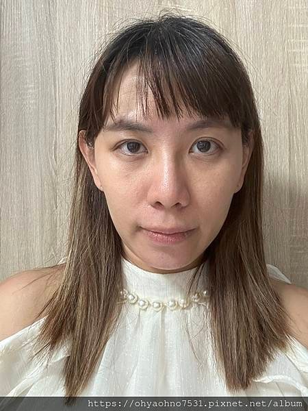 [台北音波拉提診所分享] 愛爾麗診所 非侵入式療程的HIPR