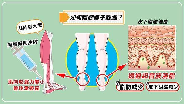 腳脖子變細.jpg